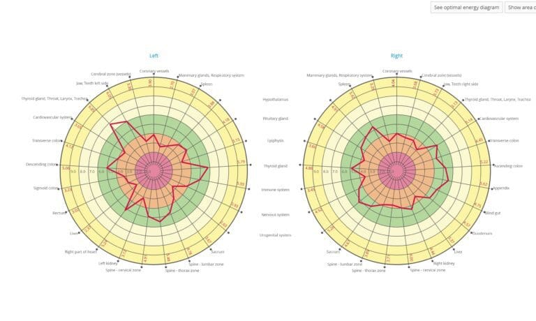 energy diagram - purpose passion and possibilities Sound Therapy using Bio-Well Energy Analysis